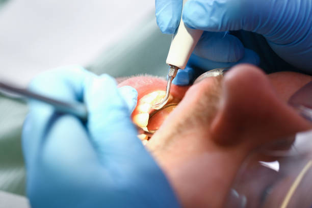 Best Emergency Dental Care for Sports Injuries in Deer Park, WA