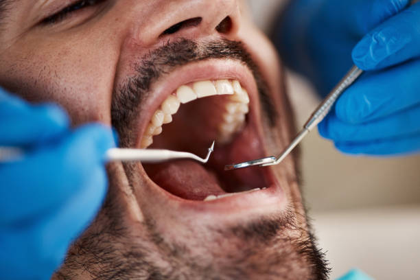 Best Dental Abscess Treatment in Deer Park, WA